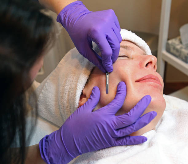 Dermaplanning + Microneedling - Combined